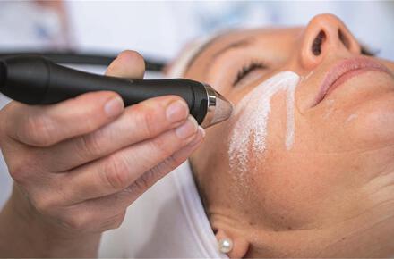 Microdermabrasion 50'