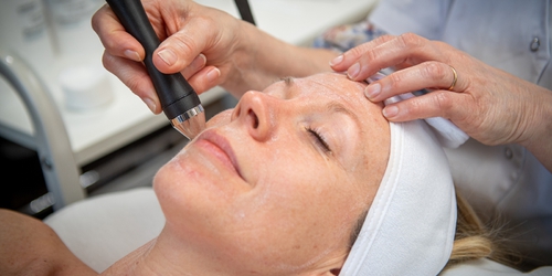 Blog_microdermabrasie-mechanische-peeling.jpg