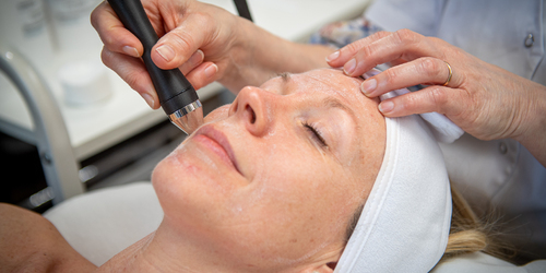 Microdermabrasie, een verjongende gelaatsverzorging met microkristallen TG_microdermabrasie.jpg